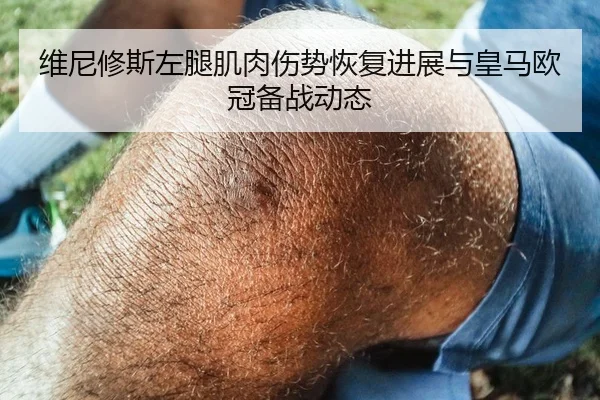 维尼修斯左腿肌肉伤势恢复进展与皇马欧冠备战动态